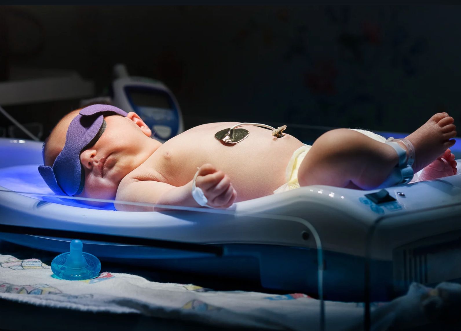 زردی نوزادان